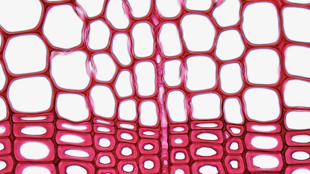 Gymnosperm Stem: Annual Rings in Pinus